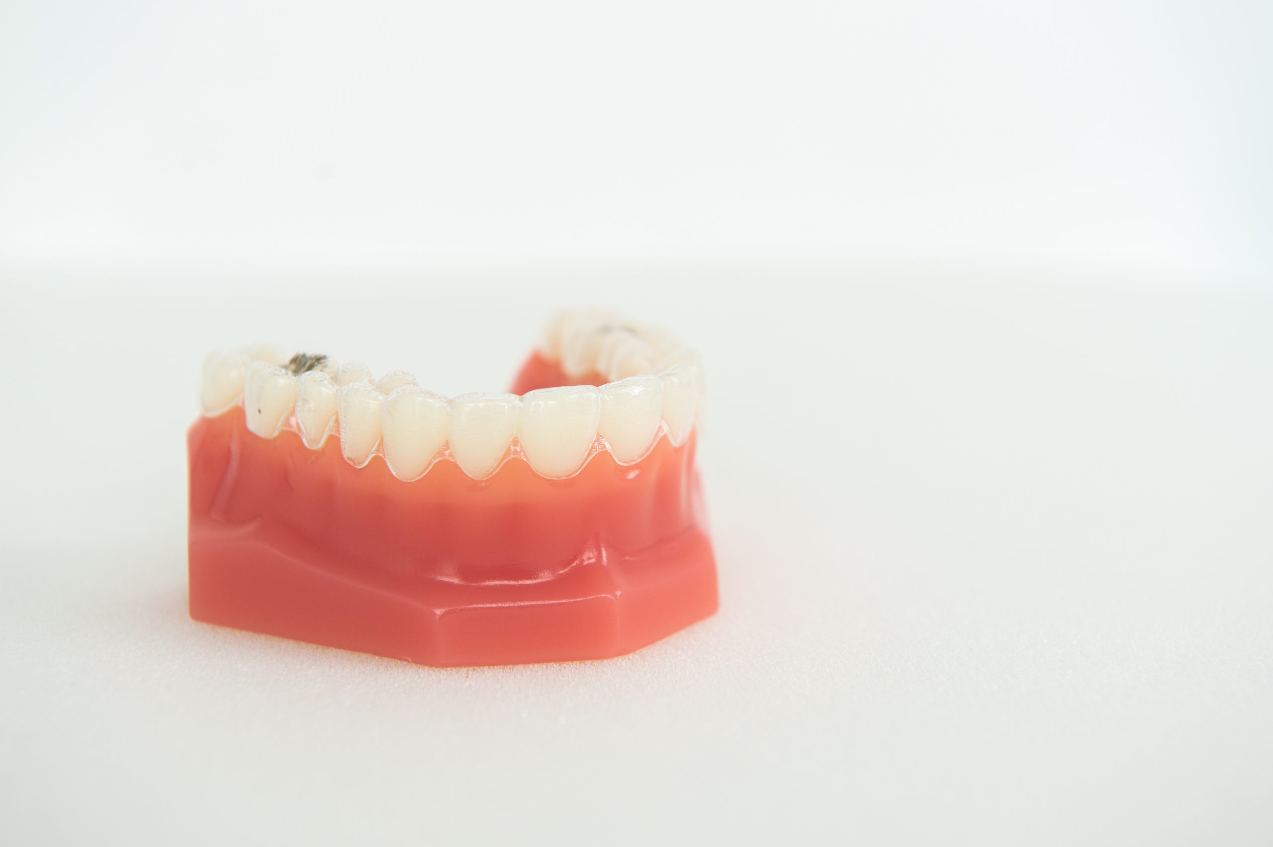 Thinking About Invisalign ? Here's What You Should Know