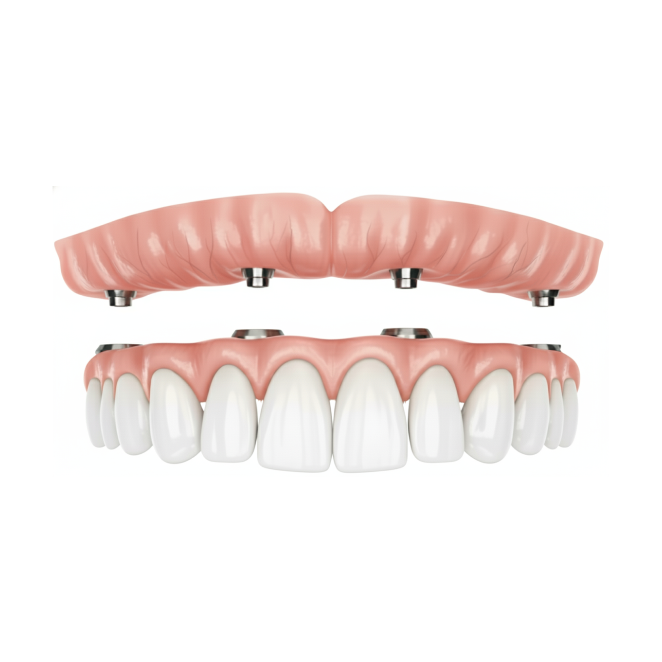 all on 4 dental implants