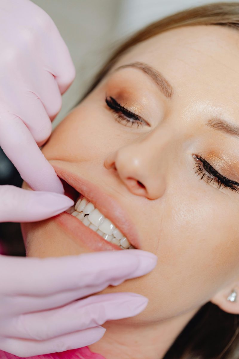 veneers west end